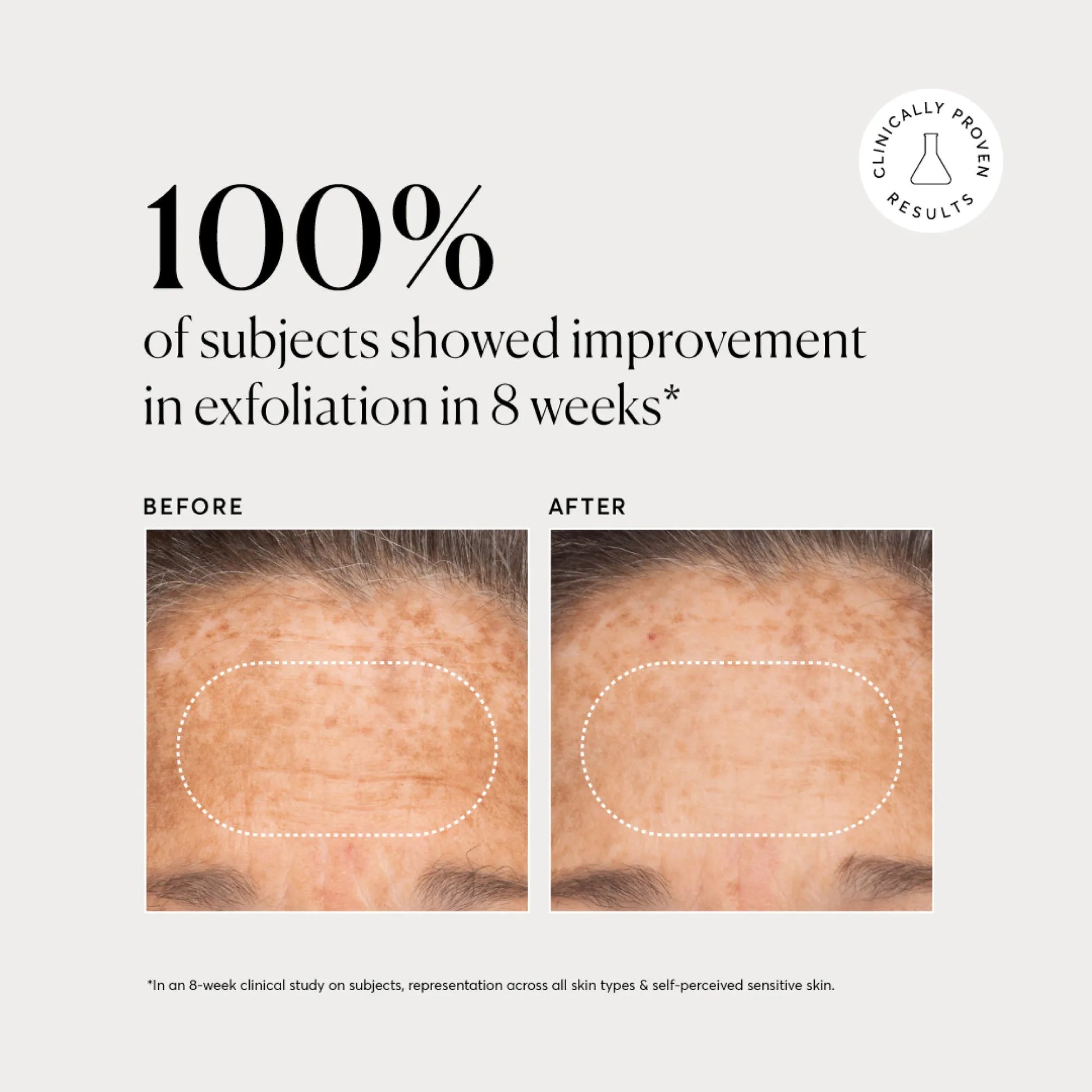 bha-liquid-exfoliant-2-l1 NATR-10027-Alt-Images-BHA-Liquid-Exfoliant-2_-03.webp