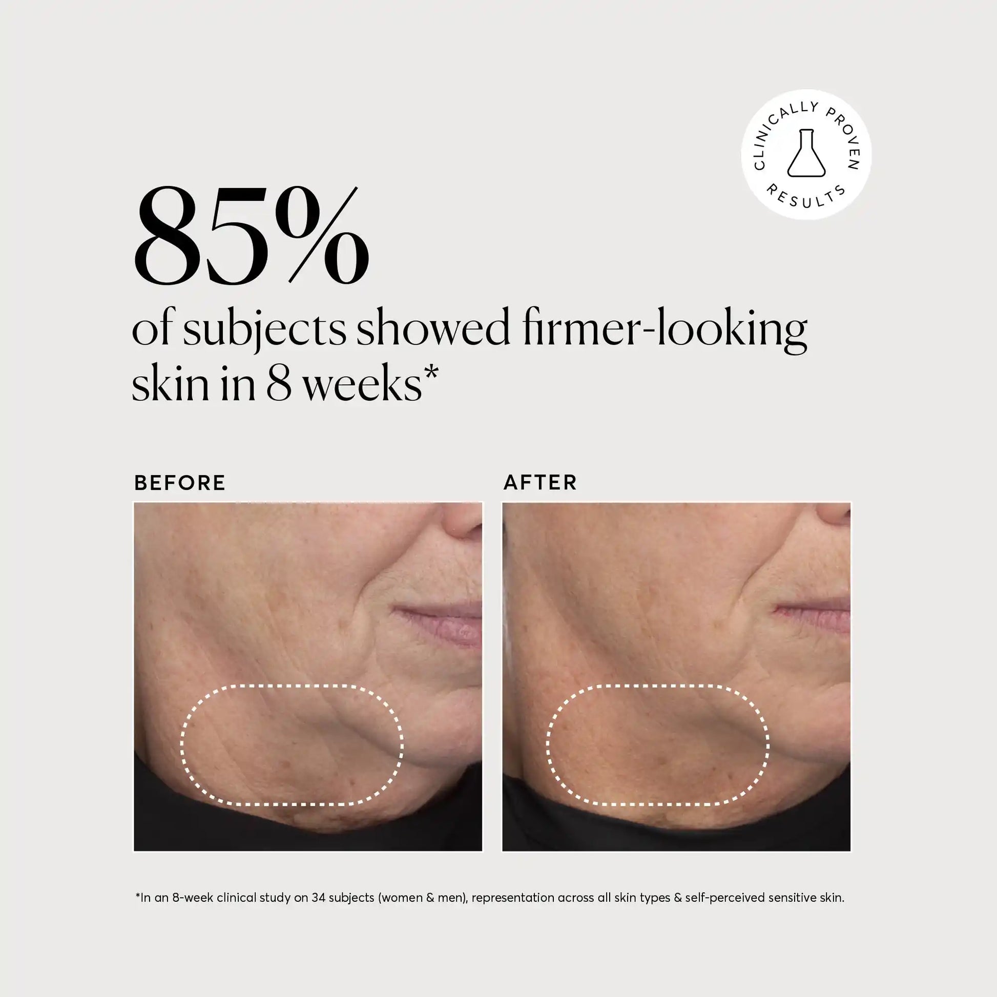 retinol-complex-serum-v0 NATR-10034-Alt-Images-Retinol-Complex-Serum-04.webp